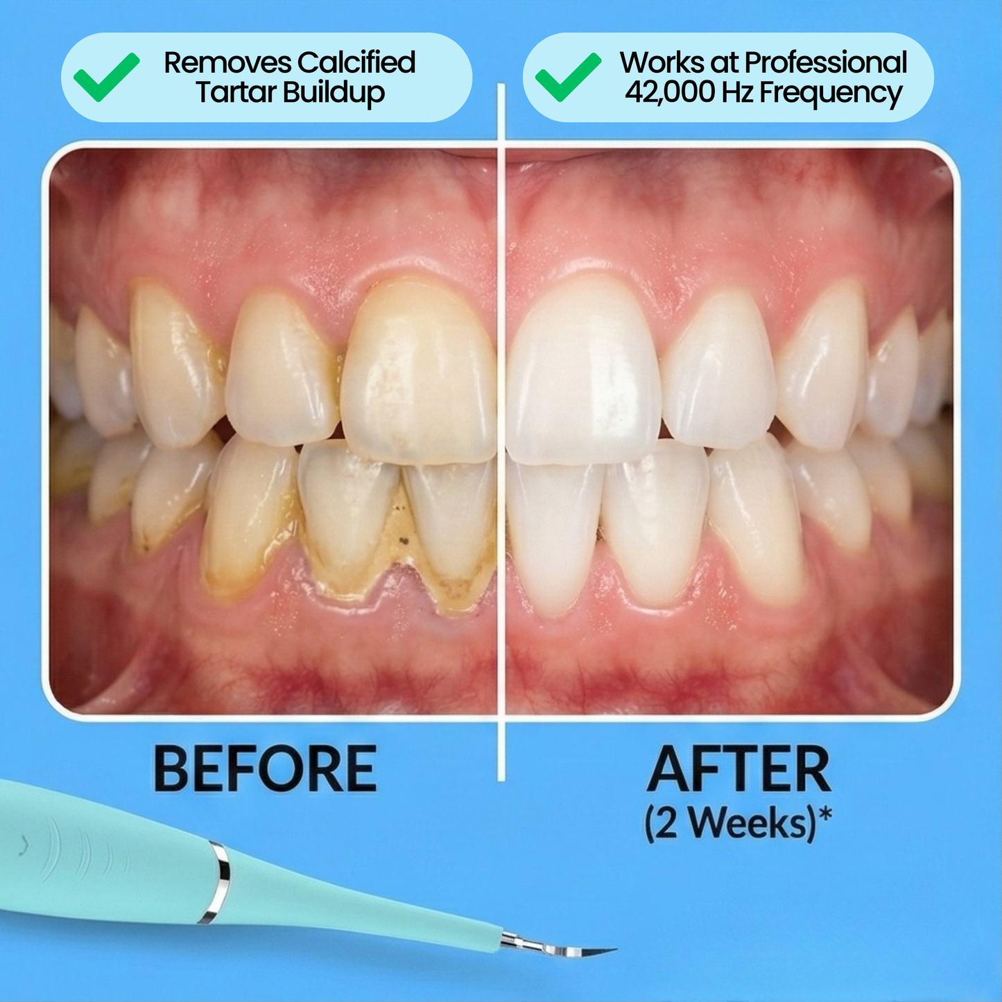 Stop Hiding Your Smile. Remove Stubborn Buildup That Won't Brush Off.